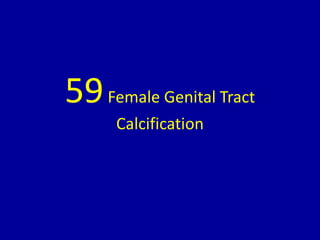 59Female Genital Tract
Calcification
 