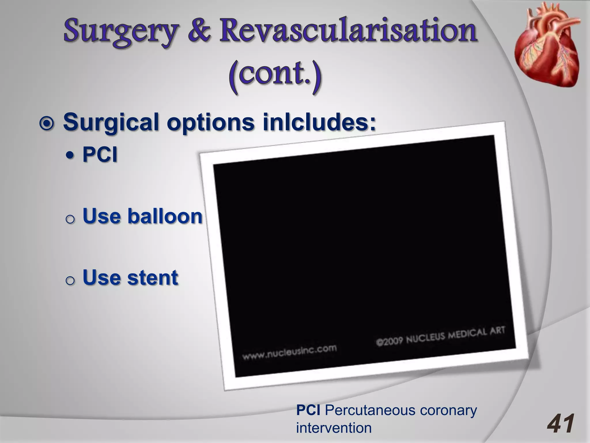  Surgical options inlcludes:
 PCI
o Use balloon
o Use stent
41
PCI Percutaneous coronary
intervention
 