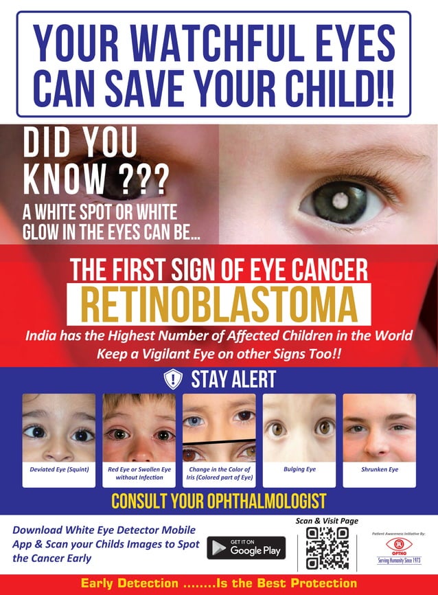 Retinoblastoma poster | PDF