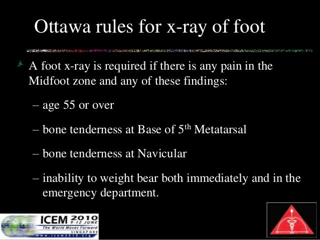 Ottawa Clinical Decision Rule A Prospective Validation Study For