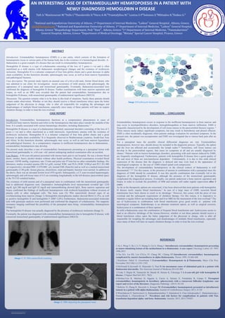 RESEARCH POSTER PRESENTATION DESIGN © 2015
www.PosterPresentations.com
Introduction: Extramedullary hematopoiesis (EMH) is a rare entity, which consists of the formation of
hematopoietic tissue in various parts of the human body due to the existence of a hematological disorder. A–
thalassemia is a great example of a disease that can result in extramedullary hematopoiesis.
Hemoglobin H disease is a type of a-thalassemia consisting of the loss of 3 genes (--/-a) and is often
manifested as a mild anemia with thalassemic morphological changes and the existence of erythrocyte
inclusions. Hemoglobin H is a tetramer composed of four beta globin chains and a great decrease in alpha
chain availability. In this hemolytic disorder, splenomegaly may occur, as well as bone marrow hyperplasia
and pathological fractures.
Case description: The present study reports an unusual case of a 64-yr-old male, former blood donor, who
was admitted to our clinic for investigation recent occurrence of mild anemia with splenomegaly, the
appearance of a paraspinal mass and monoclonal gammopathy. Eventually, thalassemia-associated tests
confirmed the diagnosis of hemoglobin H disease. Further examinations with bone marrow aspiration and
biopsy, as well as an MRI scan revealed that the patient had extramedullary hematopoiesis due to
hemoglobin H disease, with monoclonal gammopathy of undetermined significance (MGUS)
Discussion: The question remains what is to be done in this kind of situations. Surely these patients should
remain under observation. Whether or not they should receive a blood transfusion relays upon the better
judgement of the physician in charge, who is after all responsible for weighing the advantages and
disadvantages of multiple blood transfusions, especially since many of these patients will later on require
chelation therapy in order to treat the iron overload.
ABSTRACT
CASE REPORT DISCUSSION - CONCLUSIONS
REFERENCES
1.An J, Weng Y, He J, Li Y, Huang S, Cai S, Zhang J: Intrathoracic extramedullary hematopoiesis presenting
as tumor-simulating lesions of the mediastinum in α-thalassemia: A case report. Oncology Letters 10: 1993-
1996,2015
2.Chu KA, Lai RS, Lee CH,Lu JY, Chang HC, Chiang HT:Intrathoracic extramedullary haematopoiesis
complicated by massive haemothorax in alpha-thalassaemia. Thorax 1999, 54:466-468
3.Kalchiem- Dekel O, Greenbaum U:Extramedullary Hematopoiesis in β-Thalassemia. Mayo Clin Proc.
November 2015;90(11):1591-1592
4.McDonald K,Kermalli H, Majumder S, Naut E:An uncommon cause of abdominal pain in a patient with
thalassemia intermedia. The American Journal of Medicine,2014.03.005
5.Ueda T, Migita M, Yamanishi M, Maeda M, Harano K, Fukunaga Y:A 6-year-old girl with hemoglobin H
disease. J Nippon Med Sch 2011; 78(2)
6.Molina-Urra R, Martinez D, Sagasta A, Carrio A, Setoain X, Nomdedeu B, Campo E: Paraspinal
extramedullary hematopoiesis in hereditary spherocytosis with a concurrent follicular lymphoma: case
report and review of the literature. Diagnostic Pathology (2015) 10:158
7.Bobylev D, Zhang R, Haverich A, Krueger M :Extramedullary haematopoiesis presented as intrathoracic
tumour in a patient with alpha-thalassaemia. Journal of Cardiothoracic Surgery 2013, 8:120
8.Winichakoon P, Tantiworawit A, Rattanathammethee T, Hantrakool S, Chai-Adisaksopha C, Rattarittamrong e,
Norasetthada L, Charoenkwan P : Prevalence and risk factors for complications in patients with Non-
transfusion dependent alpha- and beta- thalassemia. Anemia. 2015; 2015:793025
Introduction: Extramedullary hematopoiesis functions as a compensatory phenomenon in cases of
insufficient bone marrow function and refers to the hematopoiesis that takes place outside the medulla of the
bone. It is usually associated with various hematologic disorders, including thalassemia.1–4
Hemoglobin H disease is a type of a-thalassemia (inherited, autosomal disorder) consisting of the loss of 3
genes (--/-a) and is often manifested as a mild microcytic, hypochromic anemia with the existence of
erythrocyte inclusions. Hemoglobin H is a tetramer composed of four beta globin chains and a great
decrease in alpha chain availability.5 It is frequently observed in Mediterranean countries, South-East Asia
and Africa. In this hemolytic disorder, splenomegaly may occur, as well as and bone marrow hyperplasia
and pathological fractures. As a compensatory response to inefficient hematopoiesis due to thalassaemia ,
extramedullary hematopoiesis may develop.
The present study describes a case of extramedullary hematopoiesis presenting as a paraspinal lesion with
monoclonal gammopathy in a 64-year –old patient undergoing medical examination after an accident.
Case Report : A 64-year-old patient presented with intense back pain to our hospital. He was a former blood
donor, smoker, heavy alcohol drinker without other health problems. Physical examination revealed blood
pressure 150/90 mmHg, respiratory rate 15/min and pulse rate 97/min but no other remarkable findings. His
laboratory studies revealed anemia (Hb 9,4 g/dl), normal WBC and PLTs (WBC 8100/μl and PLT 261.000
/μl respectively), elevated RBC (5.070.000 / μl), normal ESR (4mm/hr) and as well as a marked monoclonal
gammopathy (1,90 g/dl). Serum glucose, electrolytes, renal and hepatic function were normal. In addition to
the above, there was an elevated ferritin level (954 ng/ml). Subsequently, a CT scan revealed hepatomegaly,
splenomegaly and soft-tissue mass of 4.5 cm extending longitudinally in the left thoracic paravertebral space
at the T9-T10 vertebral bodies.
The existence of mild anemia and of a paraspinal mass in combination with the monoclonal gammapathy
lead to additional diagnostic tests. Quantitative immunoglobulin level measurement revealed IgG 1230
mg/dl, IgA 200 mg/dl and IgM 42 mg/dl and immunoblotting showed IgGλ. Bone marrow aspiration and
biopsy confirmed the findings of inefficient hematopoiesis with erythroid hyperplasia without invasion of
plasma cells or other malignant cells. The bone scan (Tc 99m nanocoloid) showed signs of an
overfunctioning bone marrow (Image 1) Hemoglobin electrophoretic studies showed HbA2 (1,3%), as well
as positive hemoglobin H and hemoglobin F (HbF<2,0%) Furthermore, thalassemia-associated molecular
tests with genotypic analysis were performed and confirmed the diagnosis of a-thalassemia. The magnetic
resonance imaging confirmed the possibility of the paraspinal mass being extramedullary hematopoiesis
(Image 2)
The hemoglobin H disease was actually diagnosed by the presence of erythrocyte inclusions (Image 3).
Eventually, the patient was diagnosed with extramedullary hematopoiesis due to hemoglobin H disease, with
concurrent monoclonal gammopathy of undetermined significance (MGUS).
Tsifi A.¹Mantzourani M.²Tsifis I.²Theodoridis D.³Vieru A-M.²Triantafyllou M.² Lontou S-P²Solomos Z.´Miltiadou K.µDaikos G.²
AN INTERESTING CASE OF EXTRAMEDULLARY HEMATOPOIESIS IN A PATIENT WITH
NEWLY DIAGNOSED HEMOGLOBIN H DISEASE
¹National and Kapodistrian University of Athens, 1st Department of Internal Medicine, ″Laikon″ General Hospital , Athens, Greece.
atsifi@hotmail.com ² National and Kapodistrian University of Athens, 1st Department of Internal Medicine, ″Laikon″ General Hospital,
Athens, Greece ³Biopathology Department, Pedi ″Ilion″, Athens, Greece ´1st Department of Internal Medicine, ″Pammakaristos″
General Hospital, Athens, Greece µDepartment of Medical Oncology, ″Metaxa″ Special Cancer Hospital, Piraeus, Greece
Image 2: MRI depicting the paraspinal mass
Image 1 :Tc 99m nanocolloid scanning
Image 3:Erythrocyte Inclusions
Extramedullary hematopoiesis occurs in response to the inefficient hematopoiesis in bone marrow and
may occur in myeloproliferative disorders, hemoglobinopathies or bone marrow infiltration. EMH is
frequently characterized by the development of soft tissue masses in the paravertebral thoracic regions. 6
These masses rarely induce significant symptoms, but may result in hemothorax and pleural effusion.
EMH is often incidentally diagnosed, when patients undergo evaluation for unrelated symptoms. In the
present case, the patient was asymptomatic and EMH was investigated due to intense back pain after an
accident.
For a paraspinal mass the possible clinical differential diagnoses are vast. Extramedullary
hematopoiesis, however rare, should always be included in the diagnostic process. Typically, the spleen
and the liver are affected and occasionally the lymph nodes.4,6 Sometimes, soft tissue masses can
develop in the paravertebral regions, that cause no symptoms at all and are usually diagnosed by
chance.1 Patients with no known hematologic disorders, presenting with such masses induced by EMH,
are frequently misdiagnosed. Furthermore, patients with hemoglobin H disease have a good quality of
life and most of them are non-transfusion dependent. Unfortunately, it is due to this mild clinical
expression of the disease that the diagnosis is delayed and may even lead to the appearance of
neurological symptoms in the case of EMH-related spinal cord compression.
The development of extramedullary hematopoiesis in the clinical context of thalassemia is well
documented.1–3,6,7 For this reason, in the presence of anemia in combination with a paraspinal mass the
diagnosis of EMH should be considered. It was this specific combination that eventually led to the
diagnosis of the hemoglobin H disease, although the presence of the monoclonal gammopathy
complicated the diagnostical process. Eventually, our patient underwent a bone marrow aspiration and
biopsy in order to exclude the possibility of MM and remains still under regular supervision after 3
years.
As far as the therapeutic options are concerned, it has been observed that most patients with hemoglobin
H disease rarely require blood transfusions.5 In case of a large mass of EMH, recurrent blood
transfusions have been shown to result in its shrinkage.1 However, this comes with the price of iron
overload and the subsequent requirement of chelation therapy. For this reason, it is imperative to
maintain a regular follow-up including heart and liver MRI for the measument of the iron overload.8 The
use of hydroxyurea in combination with blood transfusions gives good results in patients with
neurological symptoms. Radiotherapy is an alternate treatment option, as well as surgical excision,
hydroxyurea or a combination of these options.2
In mild a-thalassemia cases the combination of frequent blood transfusions and hydroxyurea seems to
lead to an effective shrinkage of the lesions.However, whether or not these patients should receive a
blood transfusion relays upon the better judgement of the physician in charge, who is after all
responsible for weighing the advantages and disadvantages of multiple blood transfusions, especially
since many of them will later on require chelation therapy in order to treat the iron overload.
 