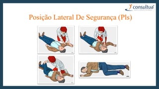 Posição Lateral De Segurança (Pls)
 