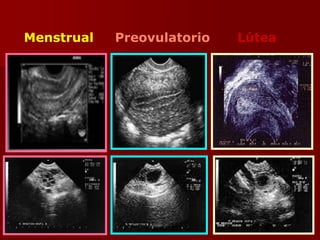 Menstrual Preovulatorio Lútea
 