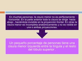 Un pequeño porcentaje de personas tiene una
cisura menor izquierda entre la língula y el resto
del lóbulo superior .
En muchas personas, la cisura menor no es perfectamente
horizontal. En la parte anterior toda la cisura se dirige hacia
abajo , haciéndola invisible en la proyección frontal. En otras la
cisura menor es incompleta anatómicamente y no es visible en
una o ambas proyecciones.
 