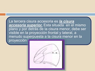 La tercera cisura accesoria es la cisura
accesoria superior. Esta situada en el mismo
plano y por detrás de la cisura menor, debe ser
visible en la proyección frontal y lateral, a
menudo superpuesta a la cisura menor en la
proyección frontal.
 