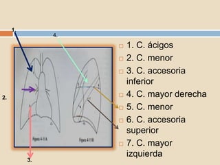  1. C. ácigos
 2. C. menor
 3. C. accesoria
inferior
 4. C. mayor derecha
 5. C. menor
 6. C. accesoria
superior
 7. C. mayor
izquierda
1.
2.
3.
4.
 