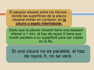 El espacio situado entre los lóbulos ,
donde las superficies de la pleura
visceral entran en contacto, es la
cisura o septo interlobular.
Dado que la pleura visceral tiene una espesor
inferior a 1 mm, el haz de rayos X tiene que
incidir paralelo a su superficie para ser visible
en la Rx.
Si una cisura no es paralela al haz
de rayos X, no se verá.
 