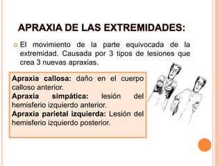 5apraxias 141218113100-conversion-gate02 | PDF