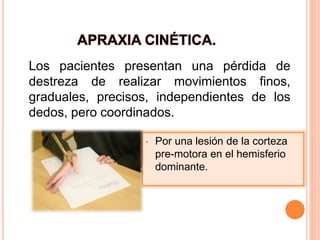 5apraxias 141218113100-conversion-gate02 | PDF
