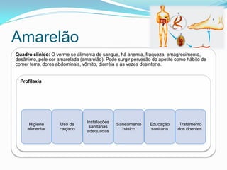 Amarelão
Quadro clínico: O verme se alimenta de sangue, há anemia, fraqueza, emagrecimento,
desânimo, pele cor amarelada (amarelão). Pode surgir pervesão do apetite como hábito de
comer terra, dores abdominais, vômito, diarréia e às vezes desinteria.
Profilaxia
Higiene
alimentar
Uso de
calçado
Instalações
sanitárias
adequadas
Saneamento
básico
Educação
sanitária
Tratamento
dos doentes.
 