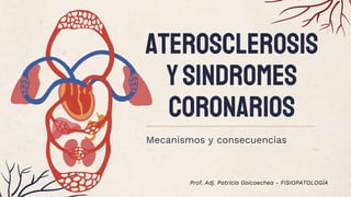 Aterosclerosis
ysindromes
coronarios
Mecanismos y consecuencias
Prof. Adj. Patricia Goicoechea - FISIOPATOLOGÍA
 