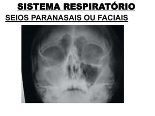 SISTEMA RESPIRATÓRIO
SEIOS PARANASAIS OU FACIAIS
 