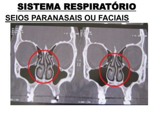 SISTEMA RESPIRATÓRIO
SEIOS PARANASAIS OU FACIAIS
 