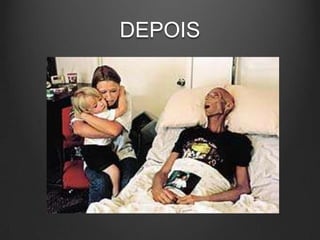 DEPOIS
 