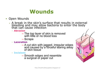 Wounds
 Open Wounds
 A break in the skin’s surface that results in external
bleeding and may allow bacteria to enter the body
that can cause infection
- Abrasion
– The top layer of skin is removed
with little or no blood loss
– Scrape
- Laceration
– A cut skin with jagged, irregular edges
and caused by a forceful tearing away
of skin tissue
- Incisions
– Smooth edges and resemble
a surgical or paper cut
http://healthsafetyupdates.blogspot.in/
 