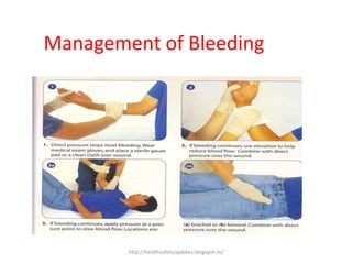 Management of Bleeding
http://healthsafetyupdates.blogspot.in/
 