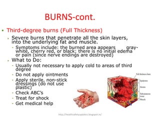 BURNS-cont.
 Third-degree burns (Full Thickness)
 Severe burns that penetrate all the skin layers,
into the underlying fat and muscle.
- Symptoms include: the burned area appears gray-
white, cherry red, or black; there is no initial edema
or pain (since nerve endings are destroyed)
 What to Do:
- Usually not necessary to apply cold to areas of third
degree
- Do not apply ointments
- Apply sterile, non-stick
dressings (do not use
plastic)
- Check ABC’s
- Treat for shock
- Get medical help
http://healthsafetyupdates.blogspot.in/
 