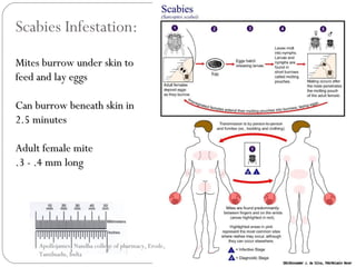 Scabies Infestation:
Mites burrow under skin toMites burrow under skin to
feed and lay eggsfeed and lay eggs
Can burrow beneath skin inCan burrow beneath skin in
2.5 minutes2.5 minutes
Adult female miteAdult female mite
.3 - .4 mm long.3 - .4 mm long
Apollojames, Nandha college of pharmacy, Erode,
Tamilnadu, India
 