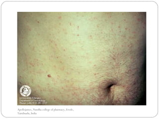 Apollojames, Nandha college of pharmacy, Erode,
Tamilnadu, India
 