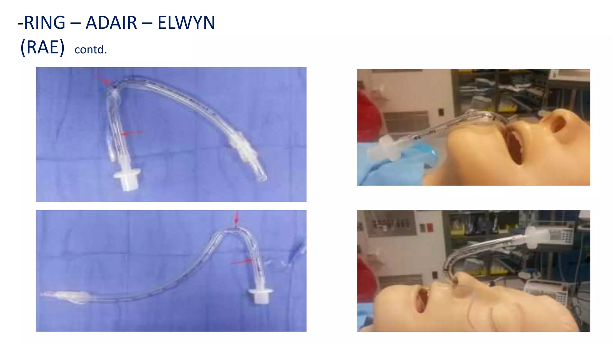 endotracheal intubation and laryngoscopy part-2-Anesthesia | PDF