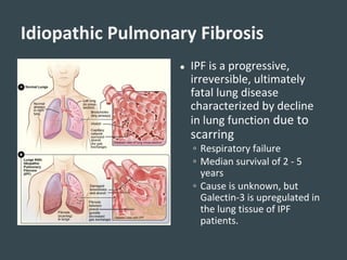 ● IPF is a progressive,
irreversible, ultimately
fatal lung disease
characterized by decline
in lung function due to
scarring
◦ Respiratory failure
◦ Median survival of 2 - 5
years
◦ Cause is unknown, but
Galectin-3 is upregulated in
the lung tissue of IPF
patients.
Idiopathic Pulmonary Fibrosis
 