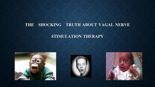 THE SHOCKING TRUTH ABOUT VAGAL NERVE
STIMULATION THERAPY
 