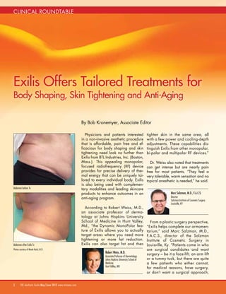 By Bob Kronemyer, Associate Editor
2 THE Aesthetic Guide May/June 2012 www.miinews.com
Physicians and patients interested
in a non-invasive aesthetic procedure
that is affordable, pain free and ef-
ficacious for body shaping and skin
tightening need look no further than
Exilis from BTL Industries, Inc. (Boston,
Mass.). This appealing monopolar,
focused radiofrequency (RF) device
provides for precise delivery of ther-
mal energy that can be uniquely tai-
lored to every individual body. Exilis
is also being used with complemen-
tary modalities and leading skincare
products to enhance outcomes in an
anti-aging program.
According to Robert Weiss, M.D.,
an associate professor of derma-
tology at Johns Hopkins University
School of Medicine in Hunt Valley,
Md., “the Dynamic MonoPolar fea-
ture of Exilis allows you to actually
target areas where you need more
tightening or more fat reduction.
Exilis can also target fat and then
tighten skin in the same area, all
with a few power and cooling-depth
adjustments. These capabilities dis-
tinguish Exilis from other monopolar,
bi-polar and multipolar RF devices.”
Dr. Weiss also noted that treatments
can get intense but are nearly pain
free for most patients. “They feel a
very tolerable, warm sensation and no
topical anesthetic is needed,” he said.
From a plastic surgery perspective,
“Exilis helps complete our armamen-
tarium,” said Marc Salzman, M.D.,
F.A.C.S., director of the Salzman
Institute of Cosmetic Surgery in
Louisville, Ky. “Patients come in who
are surgical candidates and want
surgery – be it a face-lift, an arm lift
or a tummy tuck, but there are quite
a few patients who either cannot,
for medical reasons, have surgery,
or don’t want a surgical approach,
Robert Weiss, M.D.
Associate Professor of Dermatology
Johns Hopkins University School of
Medicine
Hunt Valley, MD
Exilis Offers Tailored Treatments for
Body Shaping, Skin Tightening and Anti-Aging
clinical roundtable
Marc Salzman, M.D., F.A.C.S.
Director
Salzman Institute of Cosmetic Surgery
Louisville, KY
Abdomen before Tx
Abdomen after Exilis Tx
Photos courtesy of Marek Kacki, M.D.
 