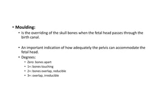 • Moulding:
• Is the overriding of the skull bones when the fetal head passes through the
birth canal.
• An important indication of how adequately the pelvis can accommodate the
fetal head.
• Degrees:
• Zero: bones apart
• 1+: bones touching
• 2+: bones overlap, reducible
• 3+: overlap, irreducible
 