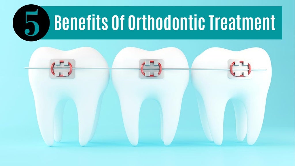 5 Benefits Of Orthodontic Treatment