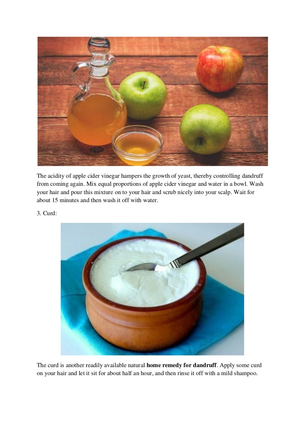 5 best home remedies to reduce dandruff naturally