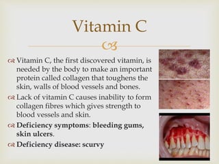 
 Vitamin C, the first discovered vitamin, is
needed by the body to make an important
protein called collagen that toughens the
skin, walls of blood vessels and bones.
 Lack of vitamin C causes inability to form
collagen fibres which gives strength to
blood vessels and skin.
 Deficiency symptoms: bleeding gums,
skin ulcers.
 Deficiency disease: scurvy
Vitamin C
 