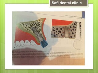 Safi dental clinic
 