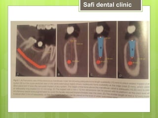 Safi dental clinic
 
