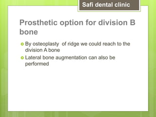 Prosthetic option for division B
bone
 By osteoplasty of ridge we could reach to the
division A bone
 Lateral bone augmentation can also be
performed
Safi dental clinic
 