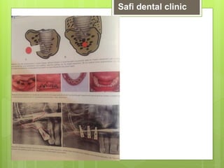 Safi dental clinic
 