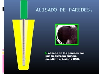 ALISADO DE PAREDES.




  6. Alisado de las paredes con
  lima hedstrôem número
  inmediato anterior a CDC.
 