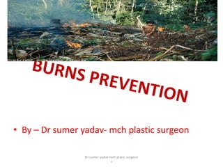 • By – Dr sumer yadav- mch plastic surgeon
Dr sumer yadav mch plasic surgeon
s
 