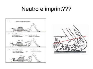Neutro e imprint???
 