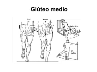 Glúteo medio
 