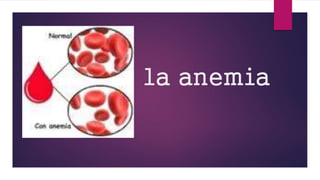 la anemia
 