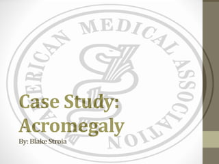 Case Study:
Acromegaly
By:BlakeStroia
 
