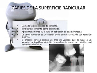 CARIES DE LA SUPERFICIE RADICULAR
• Llamada también caries de cemento.
• Involucra al cemento como al esmalte.
• Aproximadamente 40 al 70% en población de edad avanzada.
• La caries radicular es una lesión de la dentina asociada con recesión
gingival.
• El proceso carioso origina un área de vaciado que da lugar a un
aspecto radiográfico descrito normalmente como un platillo mal
definido radiolúcido.
 