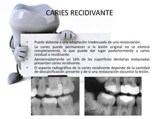 CARIES RECIDIVANTE
• Puede deberse a una adaptación inadecuada de una restauración.
• La caries puede permanecer si la lesión original no se eliminó
completamente, lo que puede dar lugar posteriormente a caries
residual o recidivante.
• Aproximadamente un 16% de las superficies dentarias restauradas
presentan caries recidivante.
• El aspecto radiográfico de la caries recidivante depende de la cantidad
de descalcificación presente y de si una restauración oscurece la lesión.
 