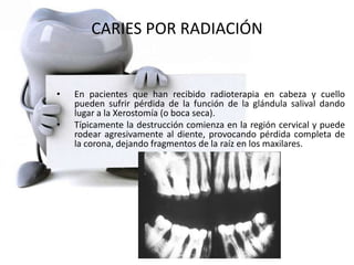 CARIES POR RADIACIÓN
• En pacientes que han recibido radioterapia en cabeza y cuello
pueden sufrir pérdida de la función de la glándula salival dando
lugar a la Xerostomía (o boca seca).
• Típicamente la destrucción comienza en la región cervical y puede
rodear agresivamente al diente, provocando pérdida completa de
la corona, dejando fragmentos de la raíz en los maxilares.
 