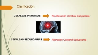 Clasificación
CEFALEAS PRIMARIAS No Alteración Cerebral Subyacente
CEFALEAS SECUNDARIAS Alteración Cerebral Subyacente
 