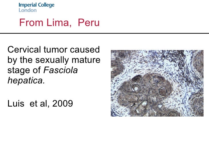 Case Reports, Infectious Diseases and the Developing World Geoffrey…