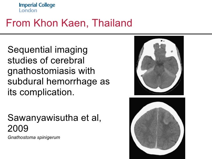 Case Reports, Infectious Diseases and the Developing World Geoffrey…
