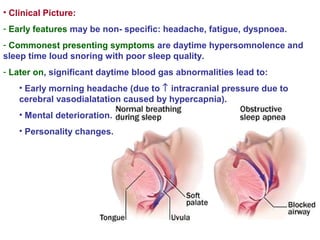 • Clinical Picture:
- Early features may be non- specific: headache, fatigue, dyspnoea.
- Commonest presenting symptoms are daytime hypersomnolence and
sleep time loud snoring with poor sleep quality.
- Later on, significant daytime blood gas abnormalities lead to:
• Early morning headache (due to ↑ intracranial pressure due to
cerebral vasodialatation caused by hypercapnia).
• Mental deterioration.
• Personality changes.
 