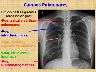 3ra-clase-usjb-rx-septimo-ciclo-pnp-pptx