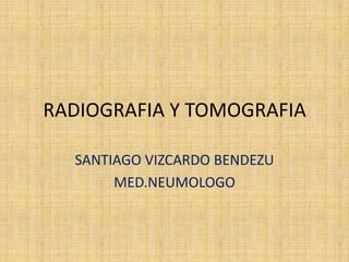 RADIOGRAFIA Y TOMOGRAFIA SANTIAGO VIZCARDO BENDEZU MED.NEUMOLOGO 